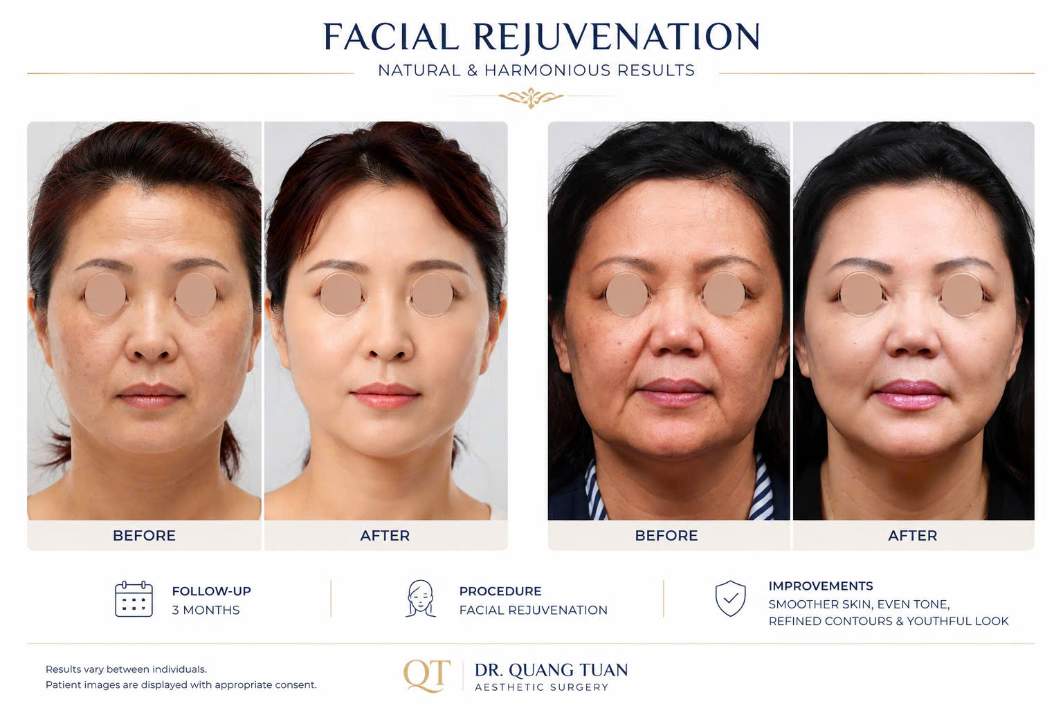 facial-01