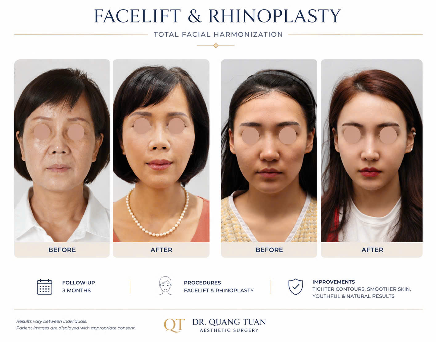 facial-02