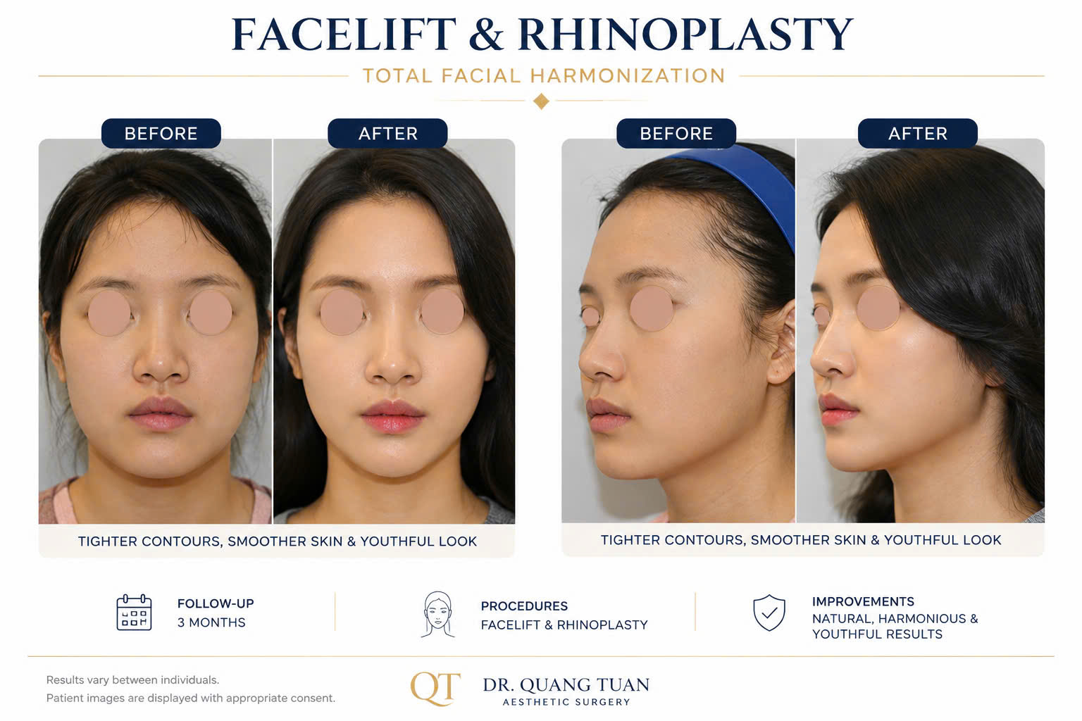 facial03